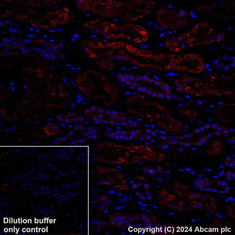 Immunohistochemistry (Formalin/PFA-fixed paraffin-embedded sections) - Alexa Fluor® 647 Anti-TNFAIP3 antibody [EPR2663] (AB197068)