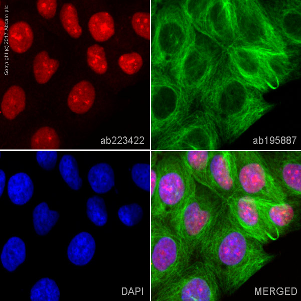 Immunocytochemistry/ Immunofluorescence - Alexa Fluor® 647 Anti-Topoisomerase I antibody [EPR5376(2)] (AB223422)