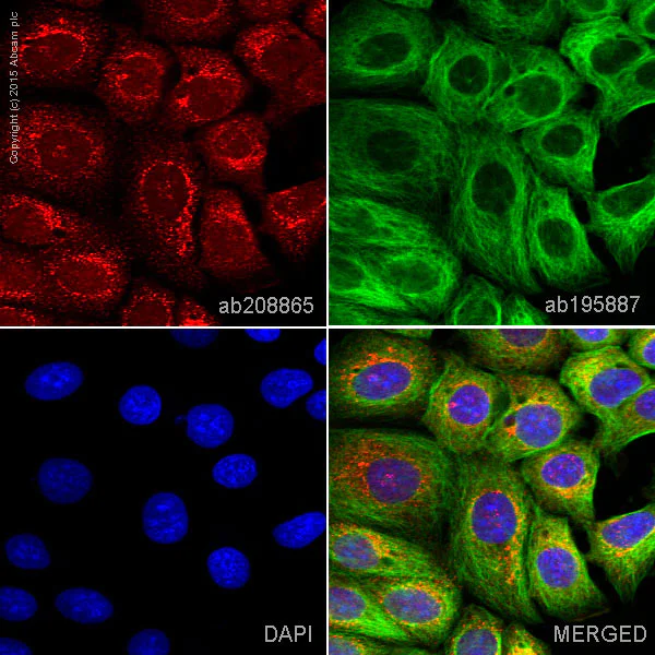 Immunocytochemistry/ Immunofluorescence - Alexa Fluor® 647 Anti-TRK fused gene antibody [EPR8766] (AB208865)