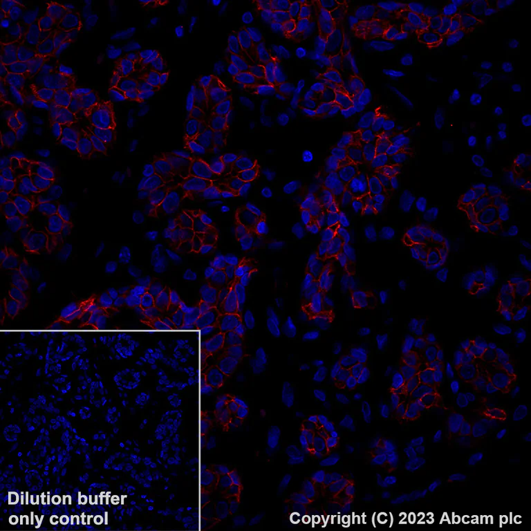 Immunohistochemistry (Formalin/PFA-fixed paraffin-embedded sections) - Alexa Fluor® 647 Anti-TROP2 antibody [EPR20043] (AB281582)