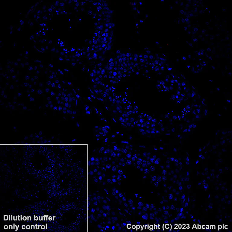 Immunohistochemistry (Formalin/PFA-fixed paraffin-embedded sections) - Alexa Fluor® 647 Anti-TROP2 antibody [EPR20043] (AB281582)