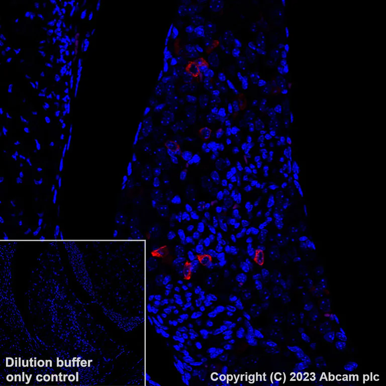 Immunohistochemistry (Formalin/PFA-fixed paraffin-embedded sections) - Alexa Fluor® 647 Anti-TRPV1 antibody [EPR25057-67] (AB313673)
