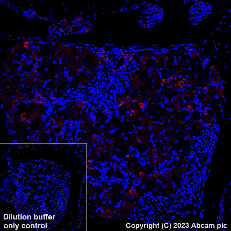 Immunohistochemistry (Formalin/PFA-fixed paraffin-embedded sections) - Alexa Fluor® 647 Anti-TRPV1 antibody [EPR25057-67] (AB313673)