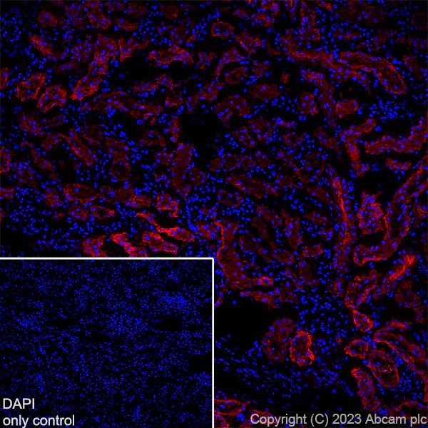 Immunohistochemistry (Frozen sections) - Alexa Fluor® 647 Anti-TRPV4 antibody [EPR23846-44] (AB315137)