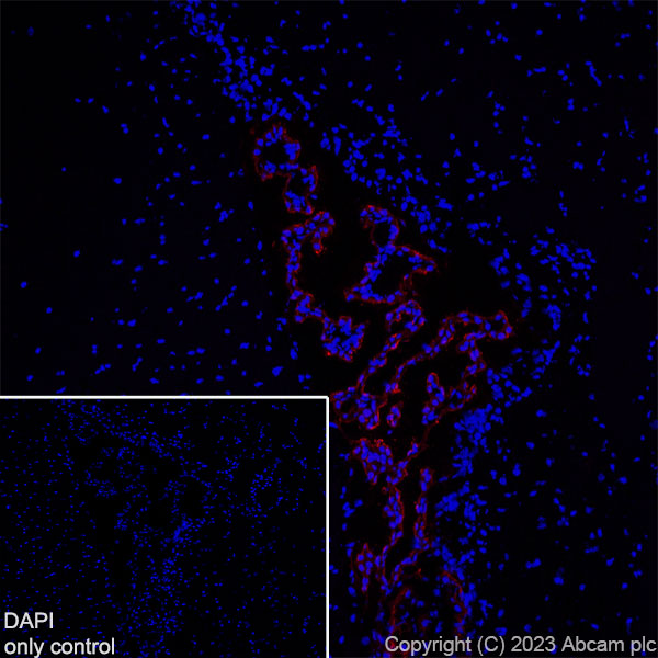 Immunohistochemistry (Frozen sections) - Alexa Fluor® 647 Anti-TRPV4 antibody [EPR23846-44] (AB315137), expandable thumbnail