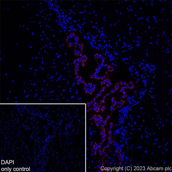 Immunohistochemistry (Frozen sections) - Alexa Fluor® 647 Anti-TRPV4 antibody [EPR23846-44] (AB315137)