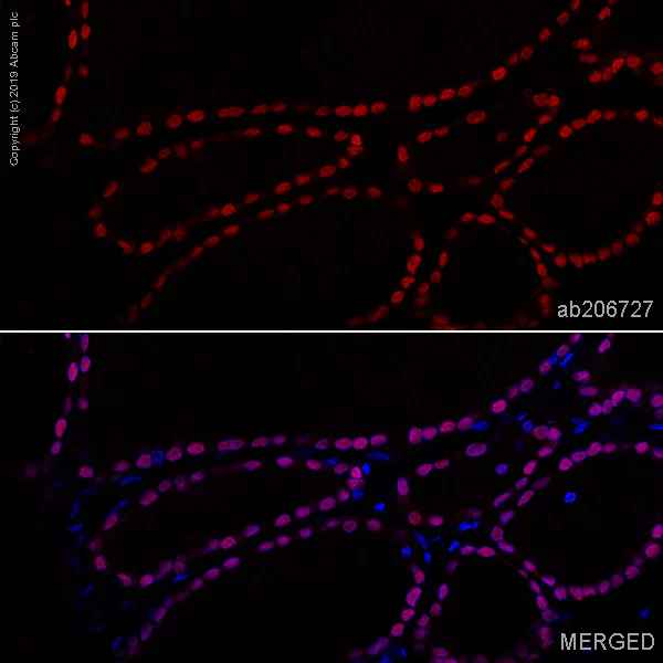 Immunohistochemistry (Formalin/PFA-fixed paraffin-embedded sections) - Alexa Fluor® 647 Anti-TTF1/Nkx2-1 antibody [EPR5955(2)] (AB206727)