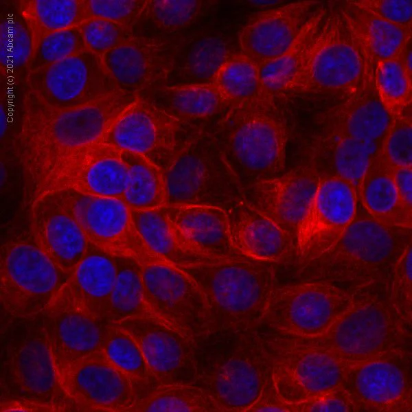 Immunocytochemistry/ Immunofluorescence - Alexa Fluor® 647 Anti-Tubulin antibody [YOL1/34] - Microtubule Marker (AB195884)