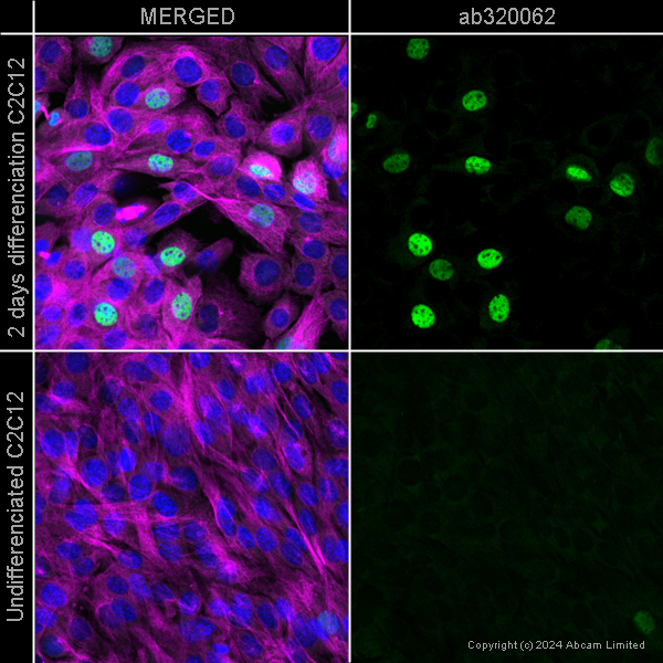 Immunocytochemistry/ Immunofluorescence - Alexa Fluor® 647 Anti-Tubulin antibody [YOL1/34] - Microtubule Marker (ab195884), expandable thumbnail
