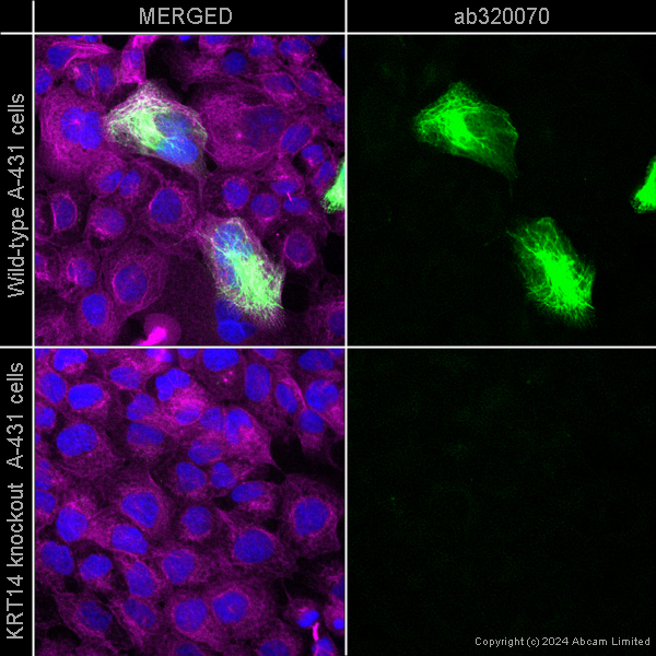 Immunocytochemistry/ Immunofluorescence - Alexa Fluor® 647 Anti-Tubulin antibody [YOL1/34] - Microtubule Marker (ab195884), expandable thumbnail
