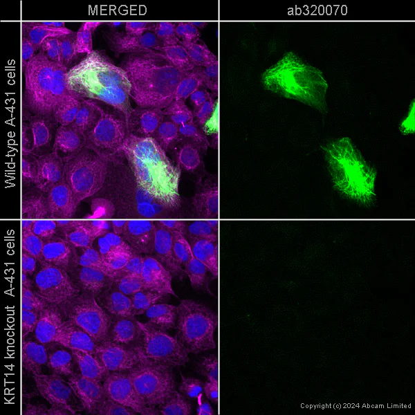 Immunocytochemistry/ Immunofluorescence - Alexa Fluor® 647 Anti-Tubulin antibody [YOL1/34] - Microtubule Marker (AB195884)