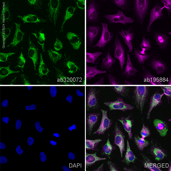 Immunocytochemistry/ Immunofluorescence - Alexa Fluor® 647 Anti-Tubulin antibody [YOL1/34] - Microtubule Marker (AB195884), expandable thumbnail