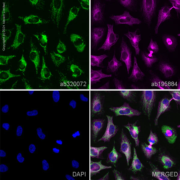 Immunocytochemistry/ Immunofluorescence - Alexa Fluor® 647 Anti-Tubulin antibody [YOL1/34] - Microtubule Marker (AB195884)