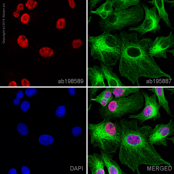 Immunocytochemistry/ Immunofluorescence - Alexa Fluor® 647 Anti-UBE2I / UBC9 antibody [EP2938Y] (AB198589)