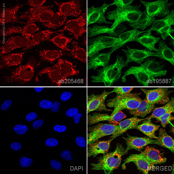 Immunocytochemistry/ Immunofluorescence - Alexa Fluor® 647 Anti-Ubiquitin antibody [EPR8830] (AB205468)