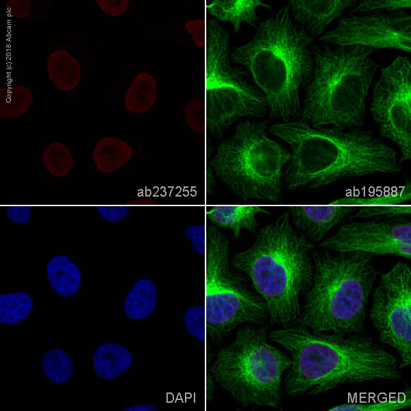 Immunocytochemistry/ Immunofluorescence - Alexa Fluor® 647 Anti-Ubiquitin (linkage-specific K27) antibody [EPR17034] (AB237255)