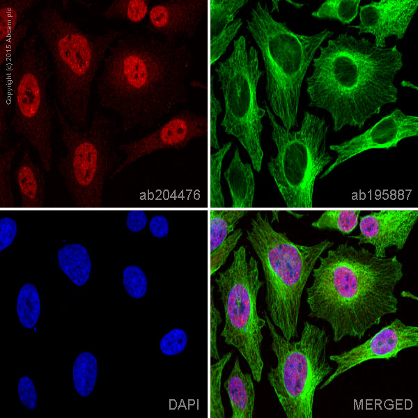 Immunocytochemistry/ Immunofluorescence - Alexa Fluor® 647 Anti-Ubiquitin (linkage-specific K48) antibody [EP8589] (AB204476), expandable thumbnail