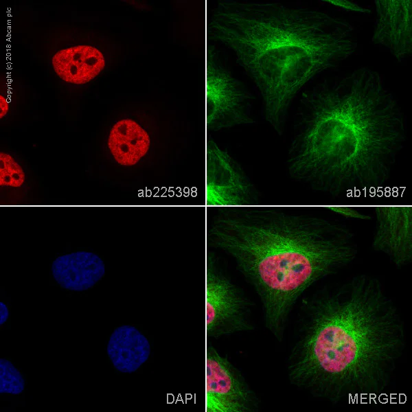 Immunocytochemistry/ Immunofluorescence - Alexa Fluor® 647 Anti-USP22 antibody [EPR18945] (AB225398)