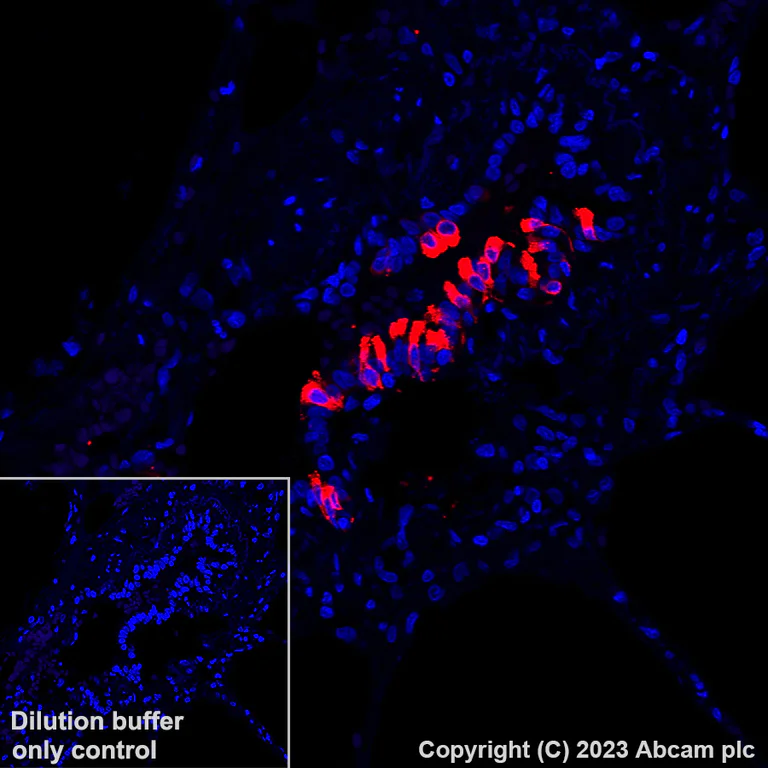 Immunohistochemistry (Formalin/PFA-fixed paraffin-embedded sections) - Alexa Fluor® 647 Anti-Uteroglobin antibody [EPR27144-86] (AB317531)
