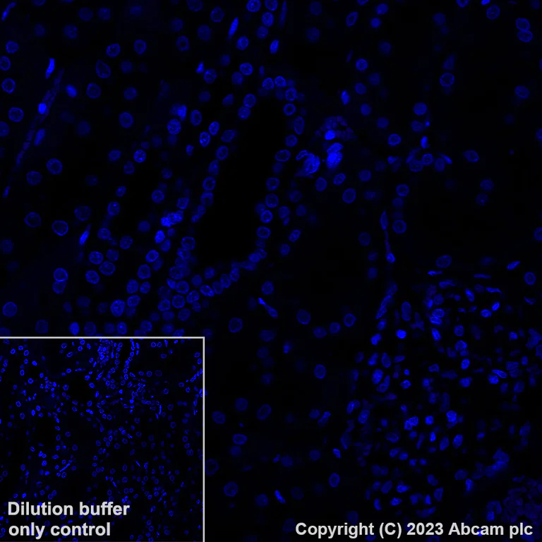 Immunohistochemistry (Formalin/PFA-fixed paraffin-embedded sections) - Alexa Fluor® 647 Anti-Uteroglobin antibody [EPR27144-86] (AB317531)