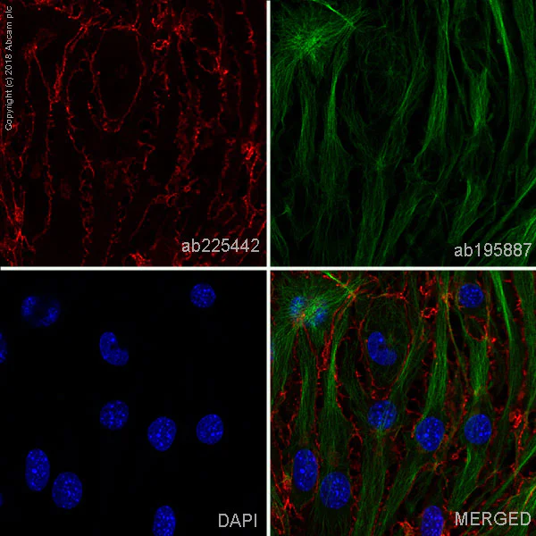 Immunocytochemistry/ Immunofluorescence - Alexa Fluor® 647 Anti-VE Cadherin antibody [EPR18229] - Intercellular Junction Marker (AB225442)