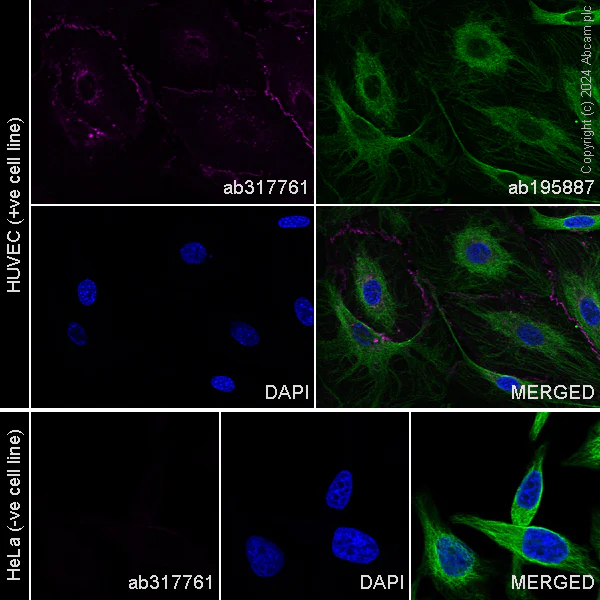 Immunocytochemistry/ Immunofluorescence - Alexa Fluor® 647 Anti-VE Cadherin antibody [EPR27436-55] (AB317761)