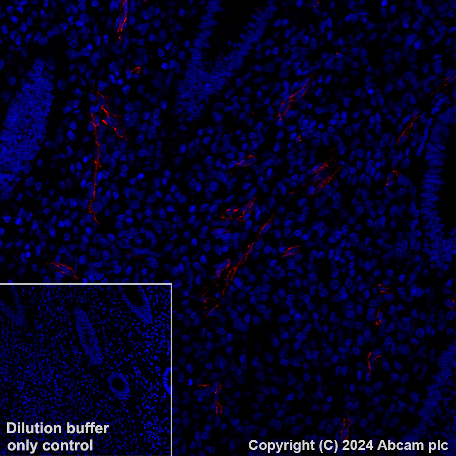 Immunohistochemistry (Formalin/PFA-fixed paraffin-embedded sections) - Alexa Fluor® 647 Anti-VE Cadherin antibody [EPR27436-55] (AB317761), expandable thumbnail