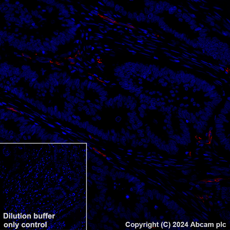 Immunohistochemistry (Formalin/PFA-fixed paraffin-embedded sections) - Alexa Fluor® 647 Anti-VE Cadherin antibody [EPR27436-55] (AB317761), expandable thumbnail
