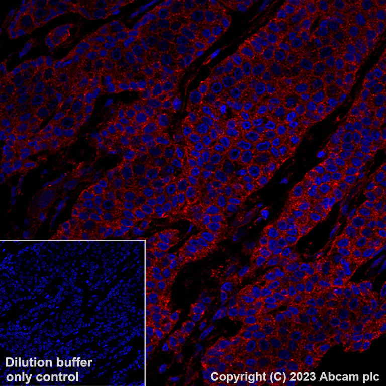 Immunohistochemistry (Formalin/PFA-fixed paraffin-embedded sections) - Alexa Fluor® 647 Anti-VEGF Receptor 1 antibody [Y103] (AB309080)