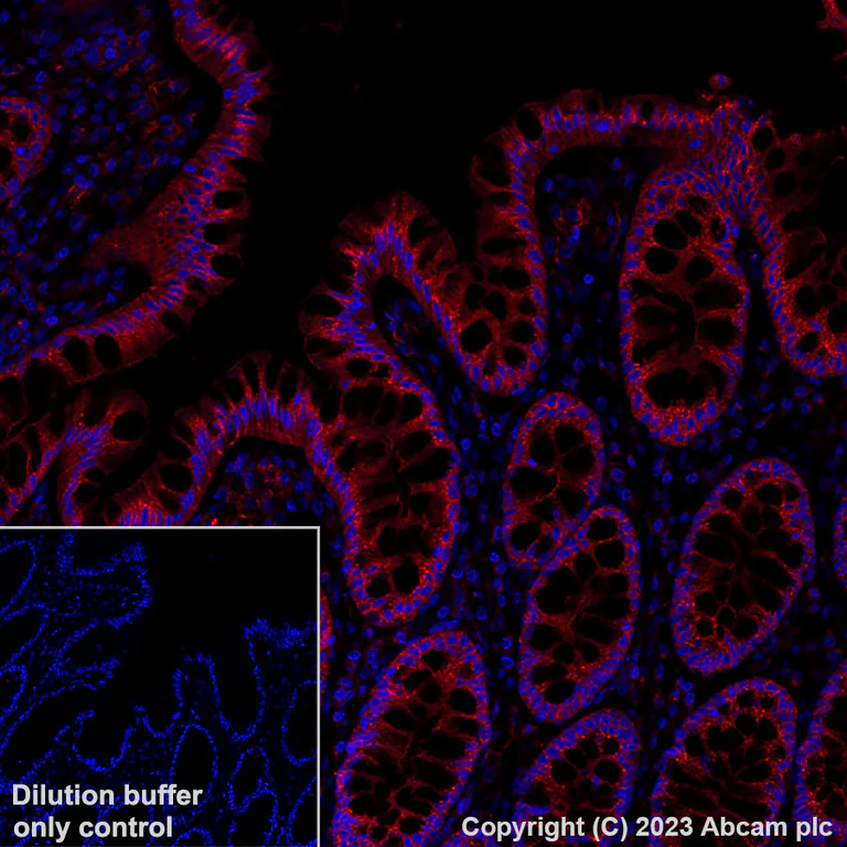 Immunohistochemistry (Formalin/PFA-fixed paraffin-embedded sections) - Alexa Fluor® 647 Anti-VEGF Receptor 1 antibody [Y103] (AB309080)