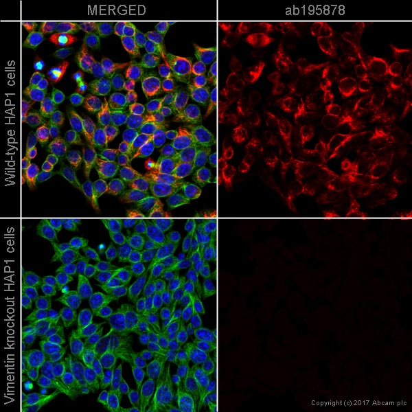 Alexa Fluor® 647 conjugated Anti-Vimentin antibody [V9