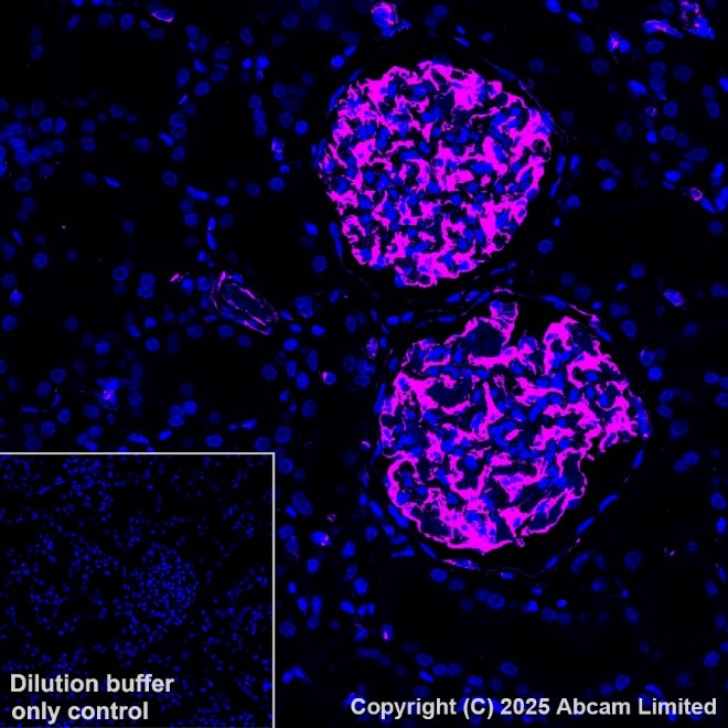 Alexa Fluor® 647 conjugated Anti-Vimentin antibody [V9