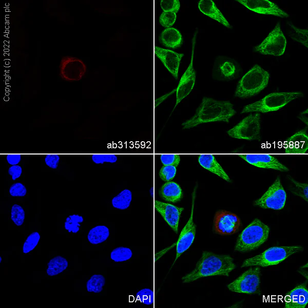 Immunocytochemistry/ Immunofluorescence - Alexa Fluor® 647 Anti-Vimentin (phospho S56) antibody [EPR21084] (AB313592)