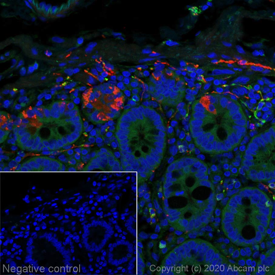 Immunohistochemistry (Formalin/PFA-fixed paraffin-embedded sections) - Alexa Fluor® 647 Anti-VIP antibody [EPR23288-43] (AB275202), expandable thumbnail