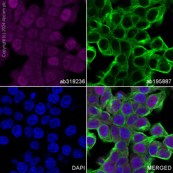 Immunocytochemistry/ Immunofluorescence - Alexa Fluor® 647 Anti-Visfatin antibody [EPR21980] (AB318236)