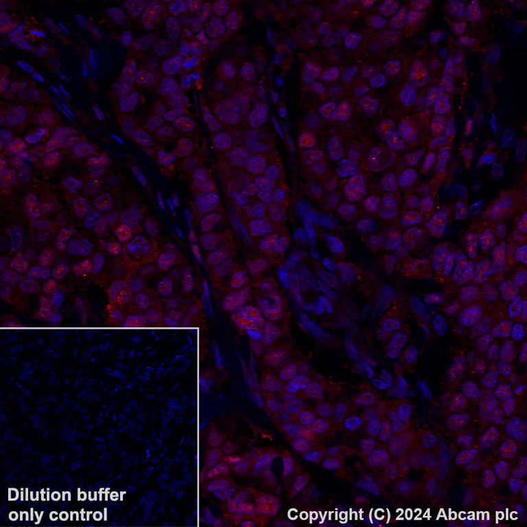 Immunohistochemistry (Formalin/PFA-fixed paraffin-embedded sections) - Alexa Fluor® 647 Anti-Visfatin antibody [EPR21980] (AB318236)