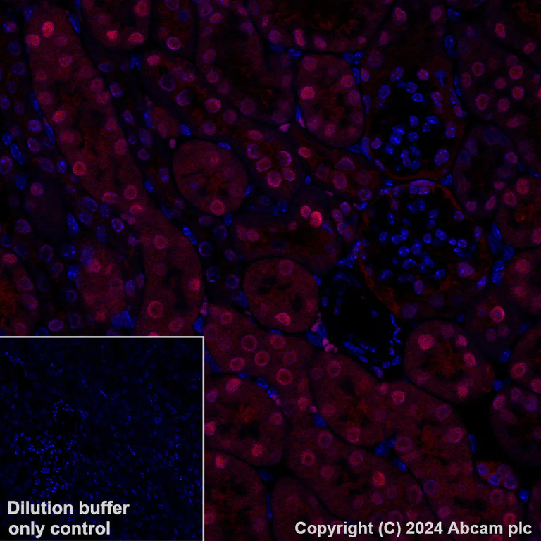 Immunohistochemistry (Formalin/PFA-fixed paraffin-embedded sections) - Alexa Fluor® 647 Anti-Visfatin antibody [EPR21980] (AB318236)