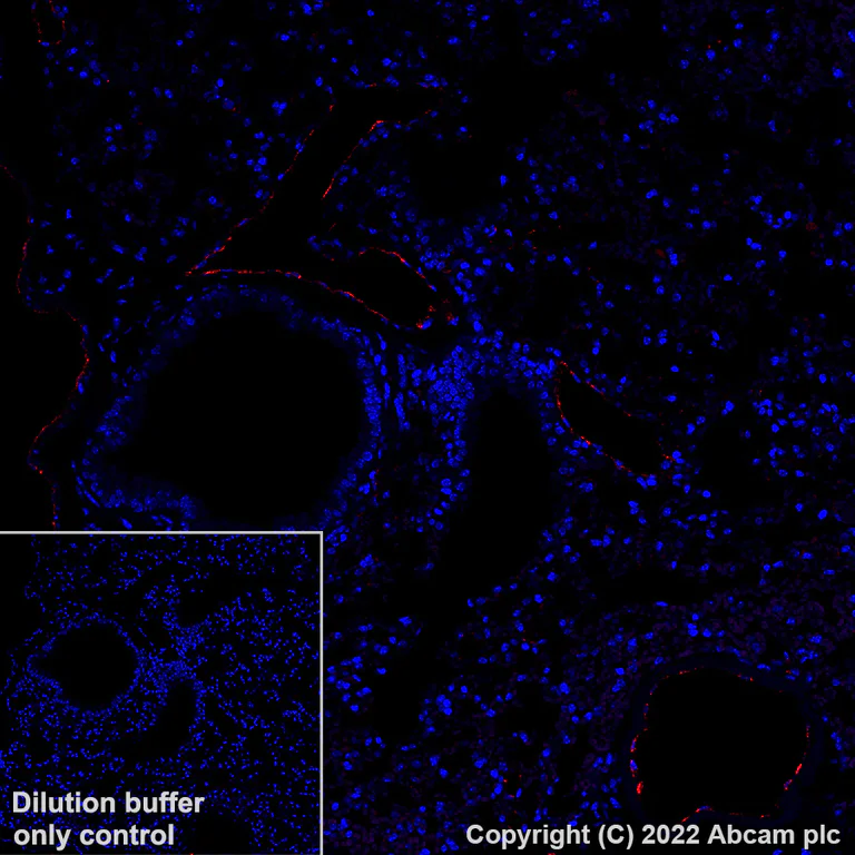 Immunohistochemistry (Formalin/PFA-fixed paraffin-embedded sections) - Alexa Fluor® 647 Anti-Von Willebrand Factor antibody [EPR25069-131] (AB307377)