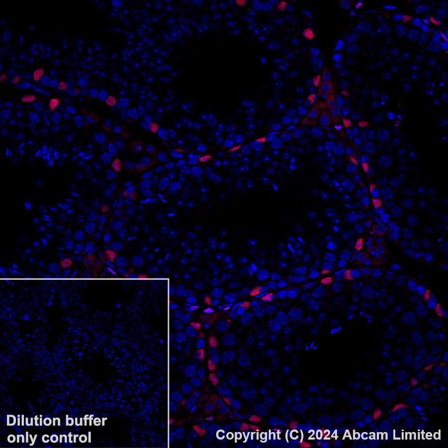 Immunohistochemistry (Formalin/PFA-fixed paraffin-embedded sections) - Alexa Fluor® 647 Anti-Wilms Tumor Protein antibody [CAN-R9(IHC)-56-2] (AB202639), expandable thumbnail