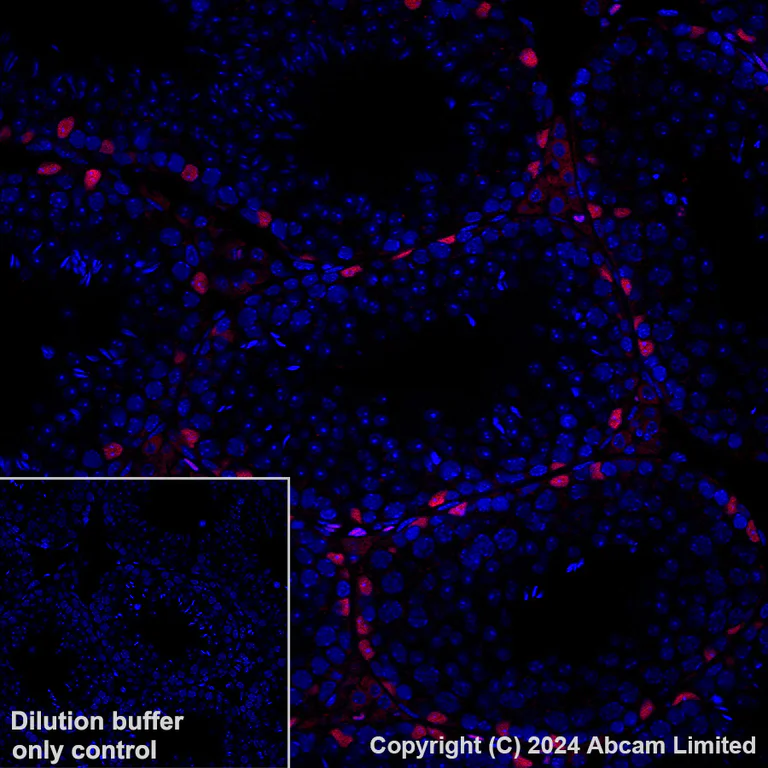 Immunohistochemistry (Formalin/PFA-fixed paraffin-embedded sections) - Alexa Fluor® 647 Anti-Wilms Tumor Protein antibody [CAN-R9(IHC)-56-2] (AB202639)