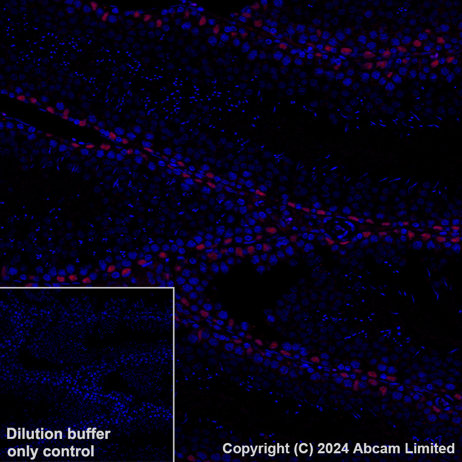 Immunohistochemistry (Formalin/PFA-fixed paraffin-embedded sections) - Alexa Fluor® 647 Anti-Wilms Tumor Protein antibody [CAN-R9(IHC)-56-2] (AB202639), expandable thumbnail