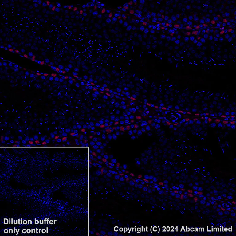 Immunohistochemistry (Formalin/PFA-fixed paraffin-embedded sections) - Alexa Fluor® 647 Anti-Wilms Tumor Protein antibody [CAN-R9(IHC)-56-2] (AB202639)