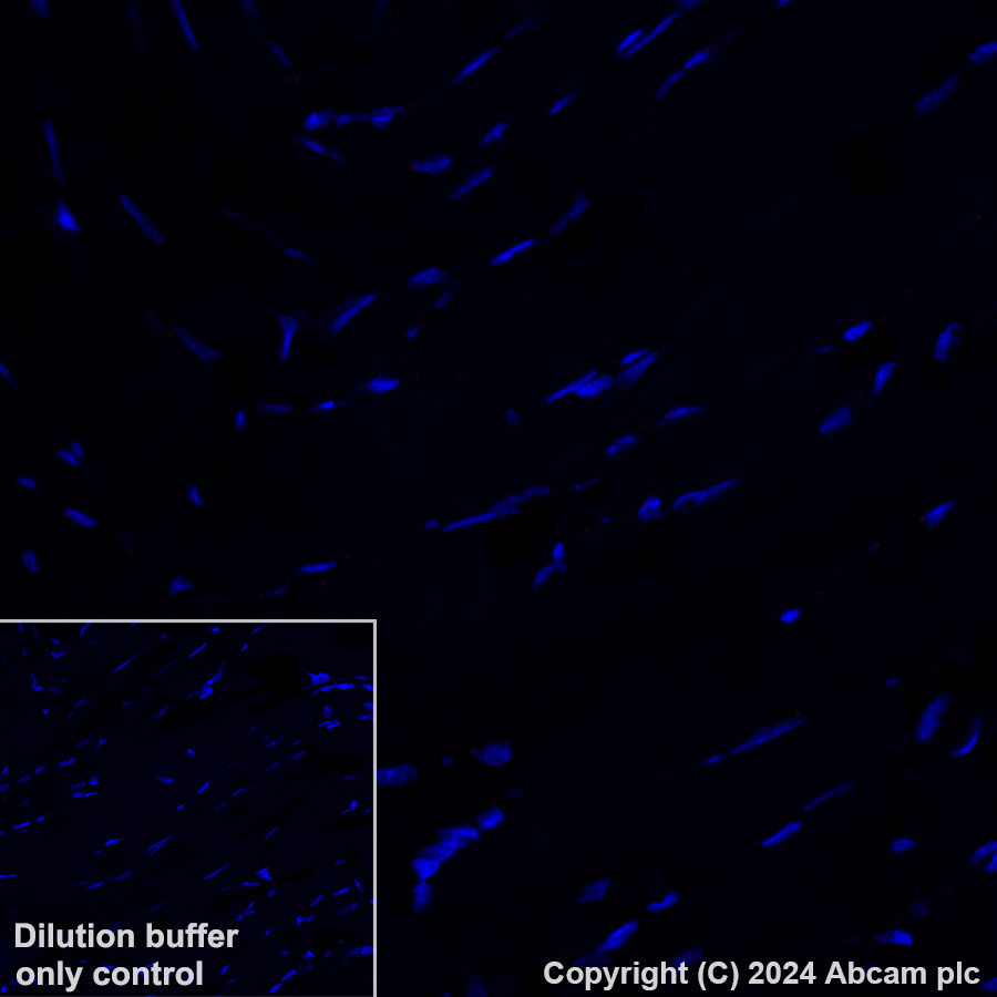 Immunohistochemistry (Formalin/PFA-fixed paraffin-embedded sections) - Alexa Fluor® 647 Anti-Wilms Tumor Protein antibody [CAN-R9(IHC)-56-2] (AB202639), expandable thumbnail