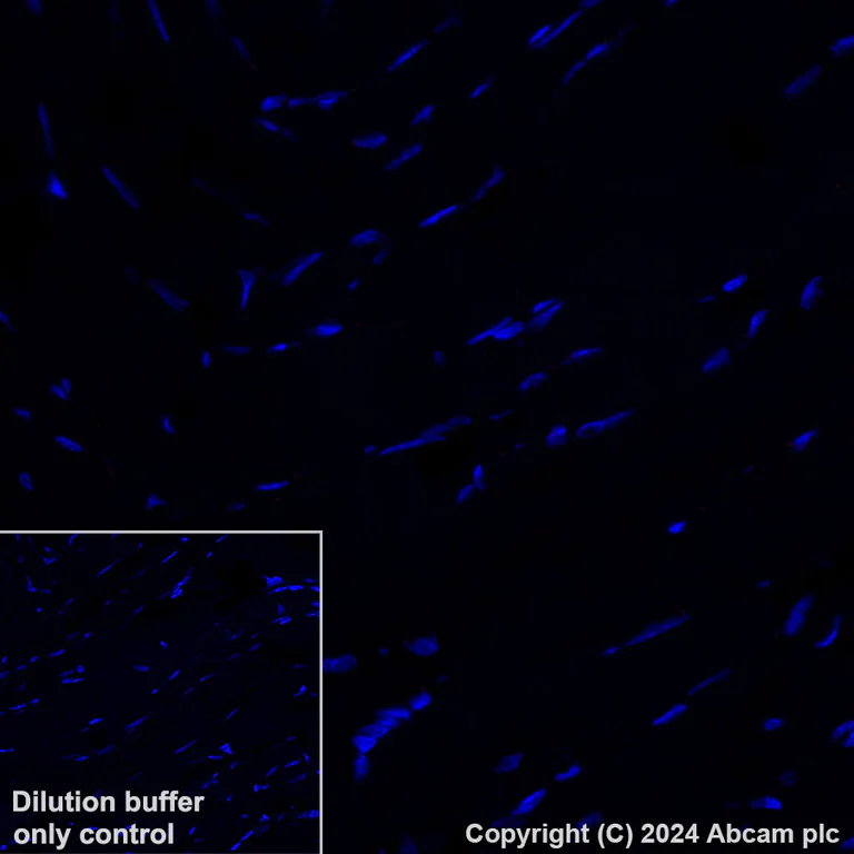 Immunohistochemistry (Formalin/PFA-fixed paraffin-embedded sections) - Alexa Fluor® 647 Anti-Wilms Tumor Protein antibody [CAN-R9(IHC)-56-2] (AB202639)