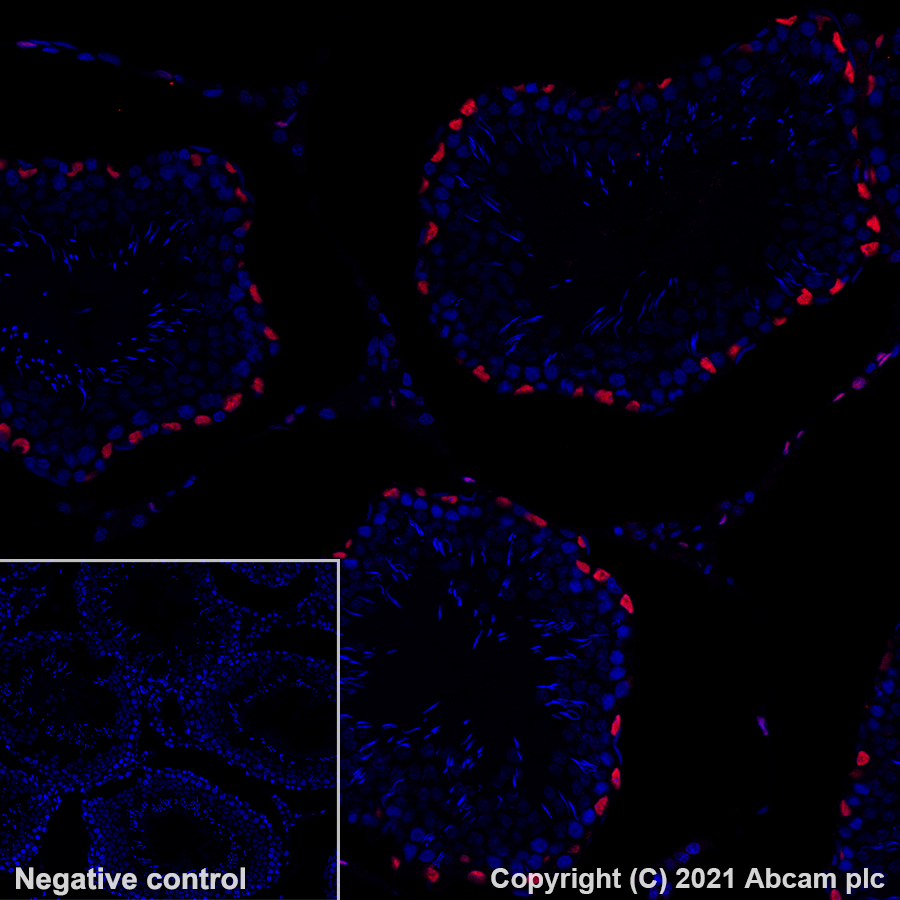 Immunohistochemistry (Formalin/PFA-fixed paraffin-embedded sections) - Alexa Fluor® 647 Anti-Wilms Tumor Protein antibody [EPR23963-116] (AB283325), expandable thumbnail