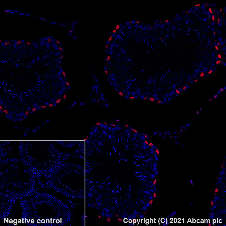 Immunohistochemistry (Formalin/PFA-fixed paraffin-embedded sections) - Alexa Fluor® 647 Anti-Wilms Tumor Protein antibody [EPR23963-116] (AB283325)