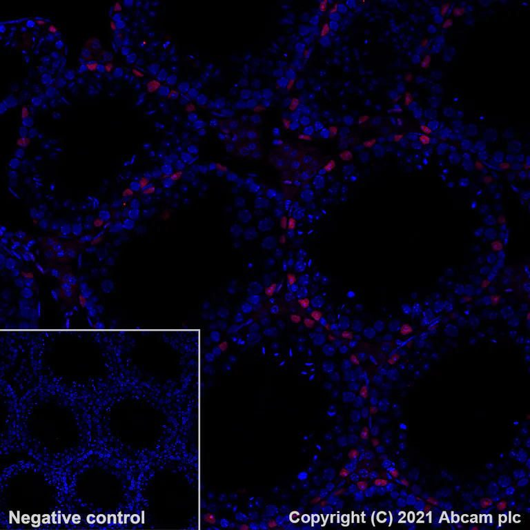 Immunohistochemistry (Formalin/PFA-fixed paraffin-embedded sections) - Alexa Fluor® 647 Anti-Wilms Tumor Protein antibody [EPR23963-116] (AB283325)