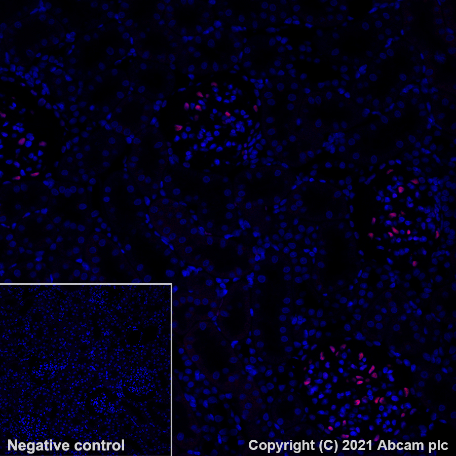 Immunohistochemistry (Formalin/PFA-fixed paraffin-embedded sections) - Alexa Fluor® 647 Anti-Wilms Tumor Protein antibody [EPR23963-116] (AB283325), expandable thumbnail