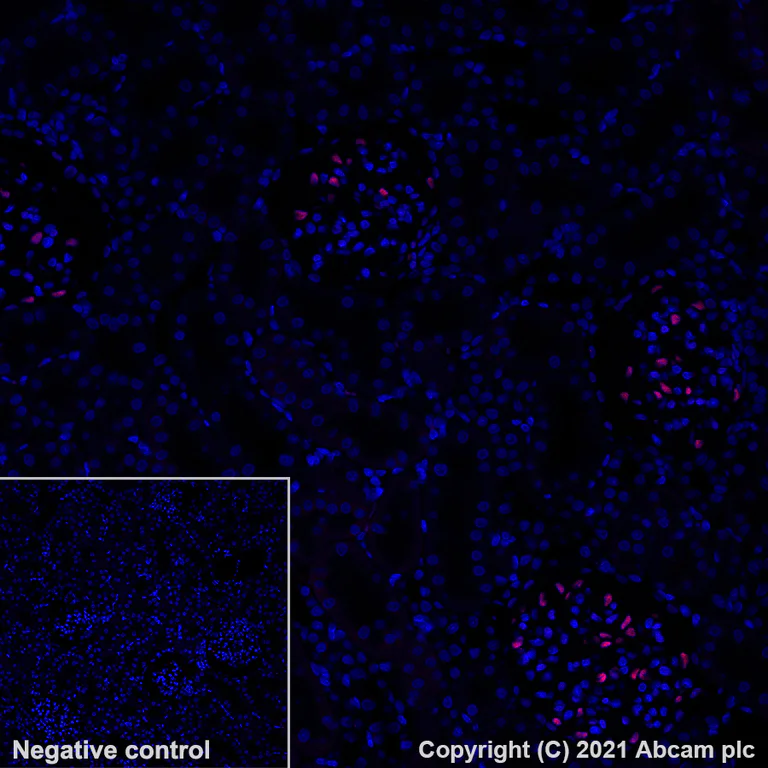 Immunohistochemistry (Formalin/PFA-fixed paraffin-embedded sections) - Alexa Fluor® 647 Anti-Wilms Tumor Protein antibody [EPR23963-116] (AB283325)