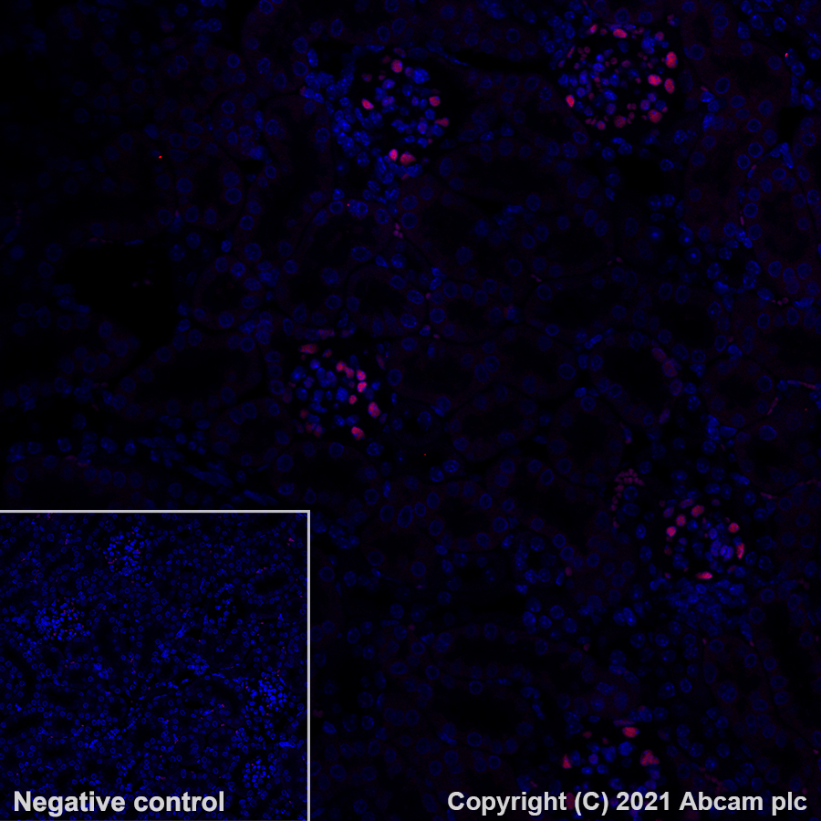 Immunohistochemistry (Formalin/PFA-fixed paraffin-embedded sections) - Alexa Fluor® 647 Anti-Wilms Tumor Protein antibody [EPR23963-116] (AB283325), expandable thumbnail